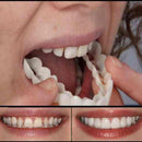 Lente de Contato Dental Removível Inferior e Superior– Resina Tooth - Fragamaialentes dentais  lentes de contato dental preço  lente para dentes  lente nos dentes  lente dentaria  lente dental  lente de dente  lente de contato para dentes  lente de contato nos dentes  lente de contato dental preço por dente  lente de contato dental preço  lente de contato dental  faceta dente  faceta dental