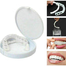 Lente de Contato Dental Removível Inferior e Superior– Resina Tooth - Fragamaialentes dentais  lentes de contato dental preço  lente para dentes  lente nos dentes  lente dentaria  lente dental  lente de dente  lente de contato para dentes  lente de contato nos dentes  lente de contato dental preço por dente  lente de contato dental preço  lente de contato dental  faceta dente  faceta dental