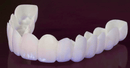 Lente de Contato Dental Removível Inferior e Superior– Resina Tooth - Fragamaialentes dentais  lentes de contato dental preço  lente para dentes  lente nos dentes  lente dentaria  lente dental  lente de dente  lente de contato para dentes  lente de contato nos dentes  lente de contato dental preço por dente  lente de contato dental preço  lente de contato dental  faceta dente  faceta dental